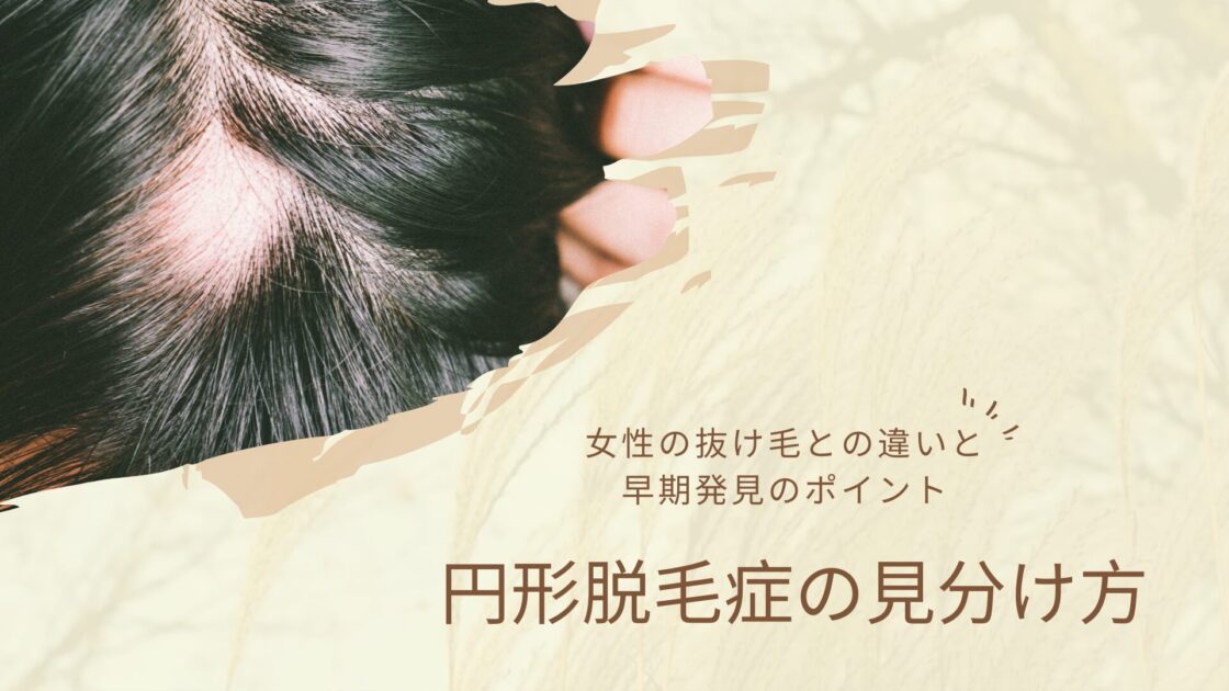 頭皮の一部が円形に抜けた写真と「円形脱毛症の見分け方」「女性の抜け毛との違いと早期発見のポイント」の文字が入ったアイキャッチ画像
